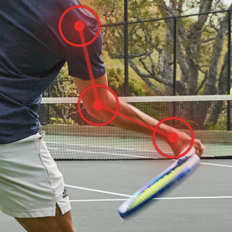 Tennis Elbow & Arm Pain